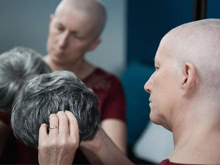 Cancer care: Does Medicare cover wigs for cancer patients?