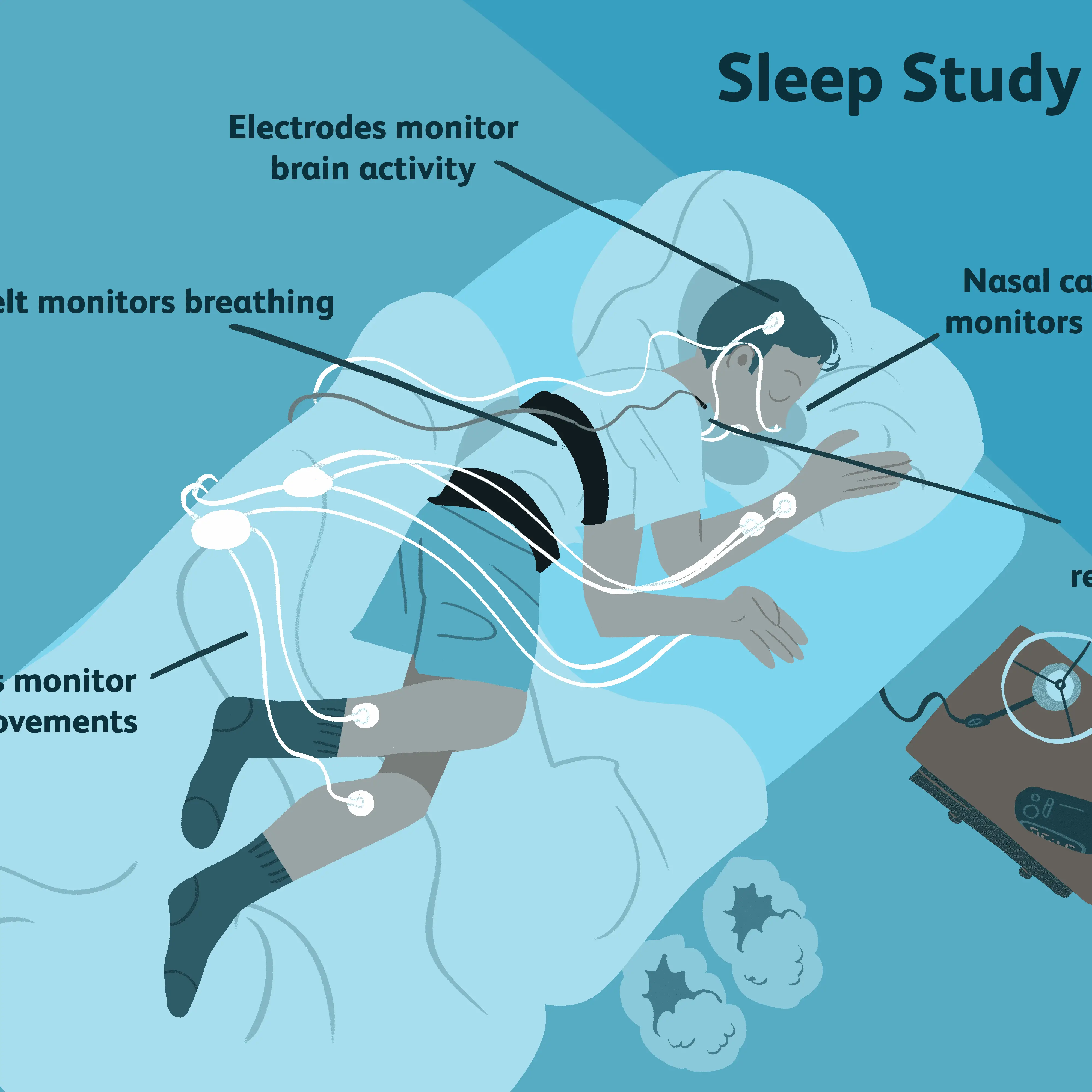 Cpt Code For Home Based Sleep Study