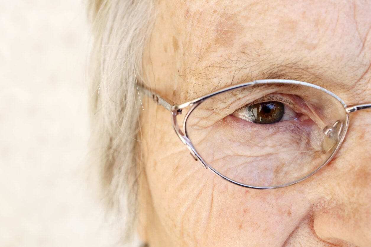 Does Medicare Cover Eyelid Surgery?