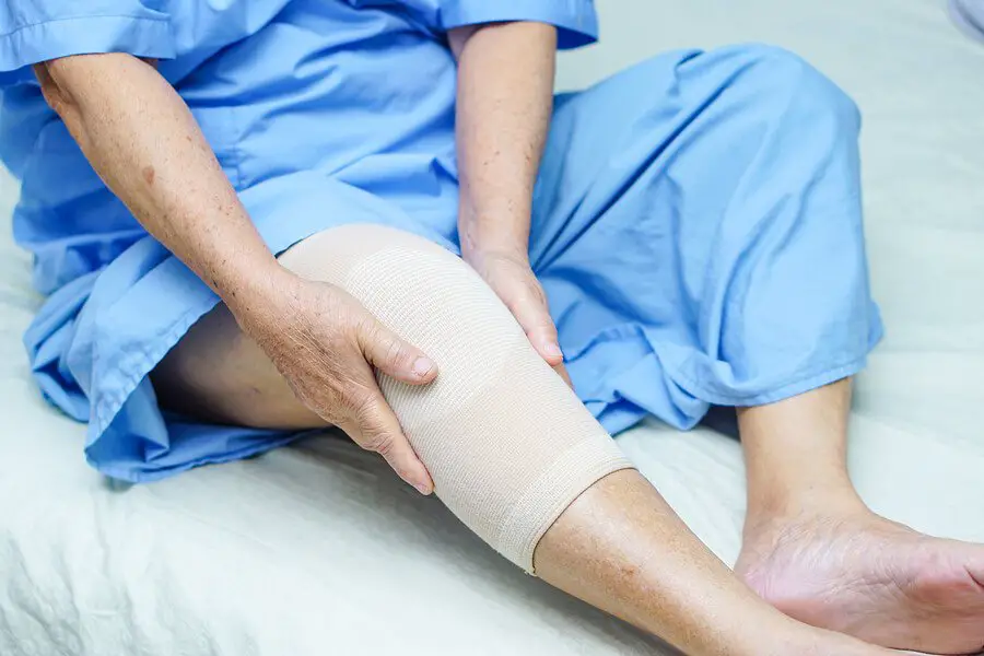 Does Medicare Cover Knee Replacement Surgery in 2021? Find Out Here