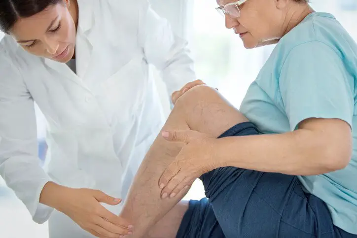 Does Medicare Cover Varicose Vein Treatment ...