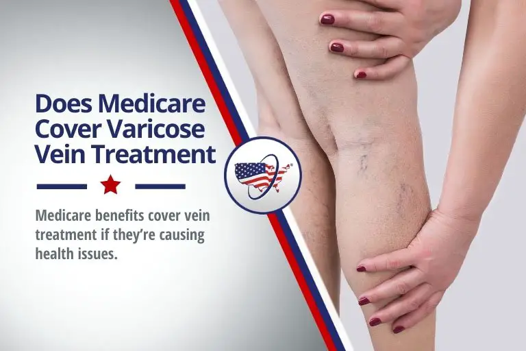 Does Medicare Cover Varicose Vein Treatments