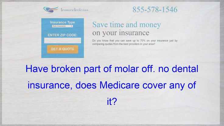 Have broken part of molar off. no dental insurance, does Medicare cover ...