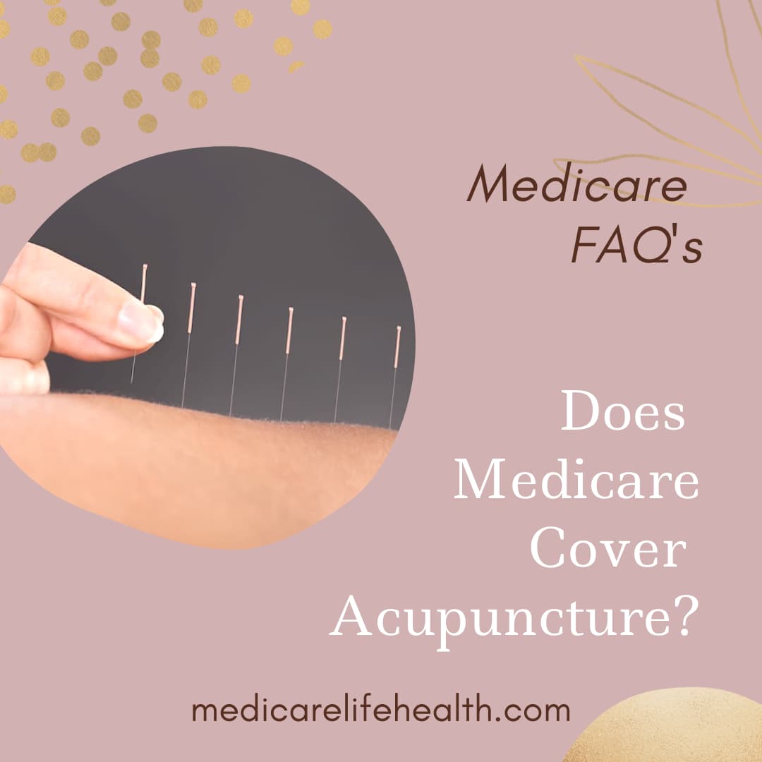 Is Acupuncture Covered by Medicare