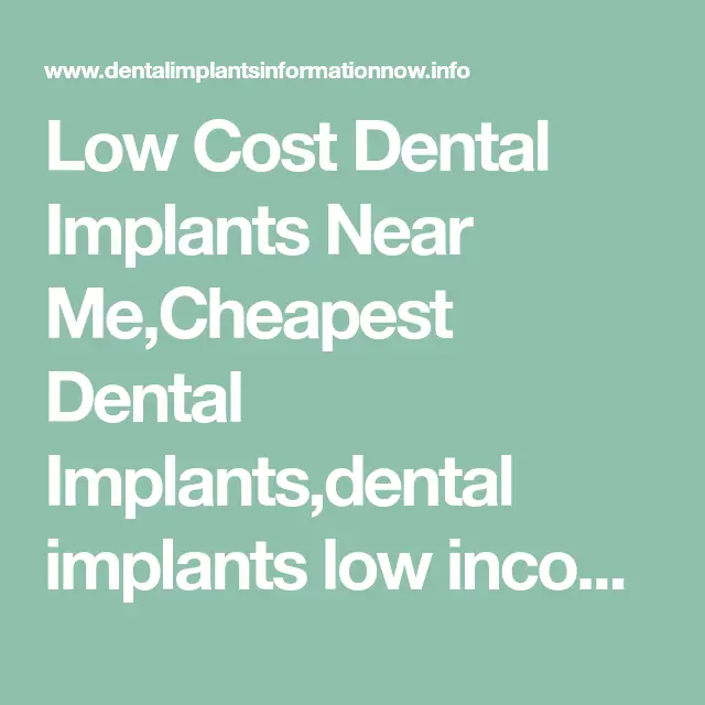 Low Cost Dental Implants Near Me,Cheapest Dental Implants,dental ...