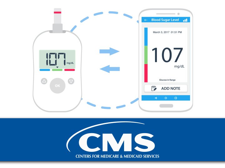 Medicare Loosens Rules on Continuous Glucose Monitors ...