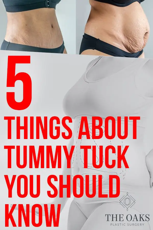 What Health Insurance Covers Tummy Tucks