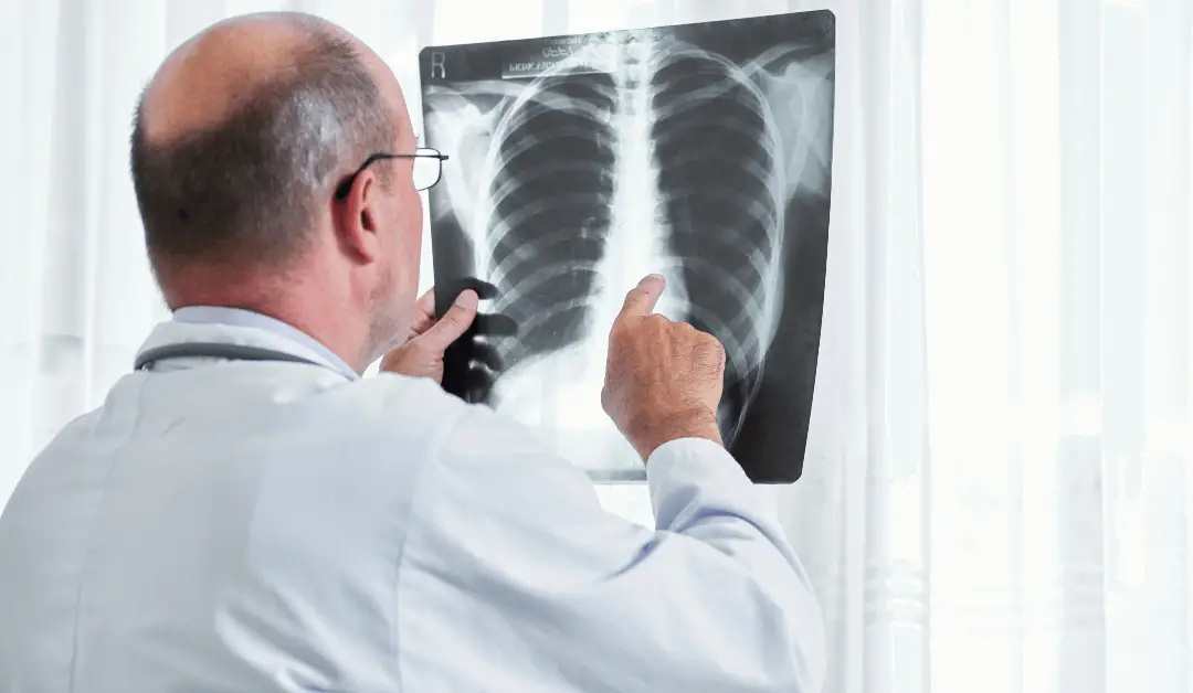 Will Your Florida Medicare Plans Cover Lung Cancer, Learn ...